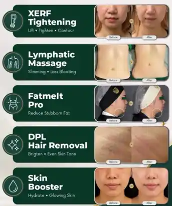 Embba treatment list including XERF tightening, lymphatic massage, fatmelt pro, DPL hair removal, and skin booster